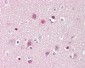 ADD1 Antibody (aa411-460)